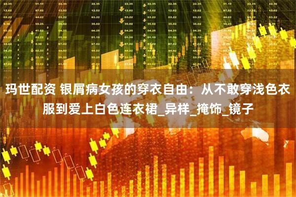玛世配资 银屑病女孩的穿衣自由：从不敢穿浅色衣服到爱上白色连衣裙_异样_掩饰_镜子